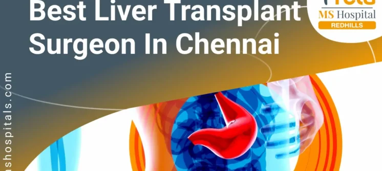 Best Liver Transplant Surgeon in Chennai