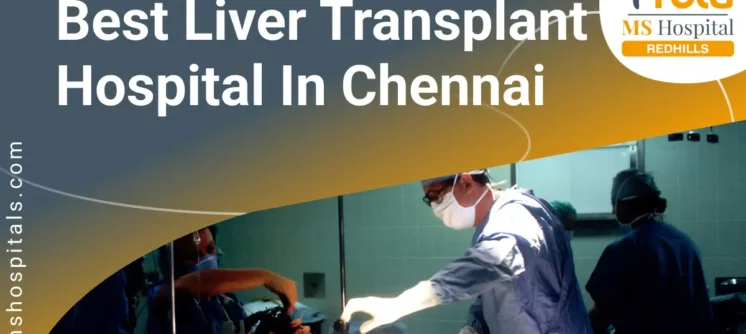 Best liver transplant hospital in Chennai