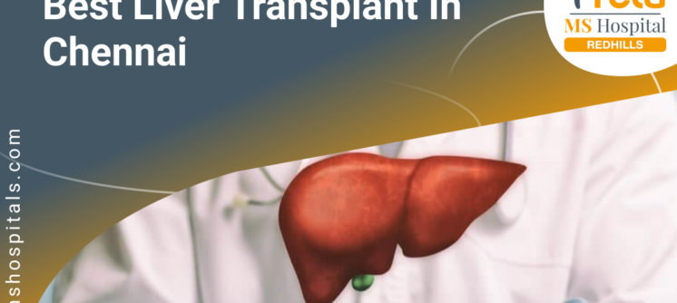 Liver Transplant in Chennai