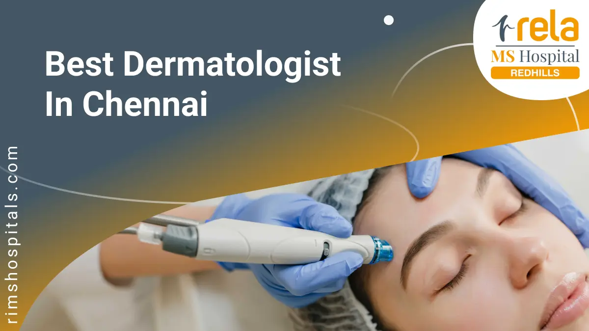 Best Dermatologist in Chennai
