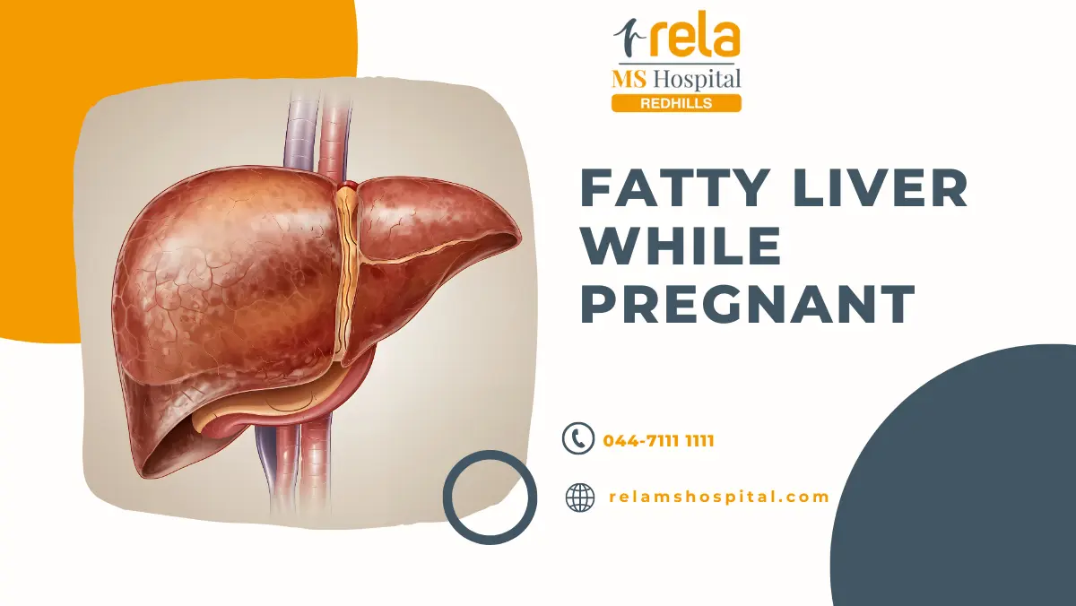 Fatty Liver While Pregnant – Understanding the Risks and Treatment