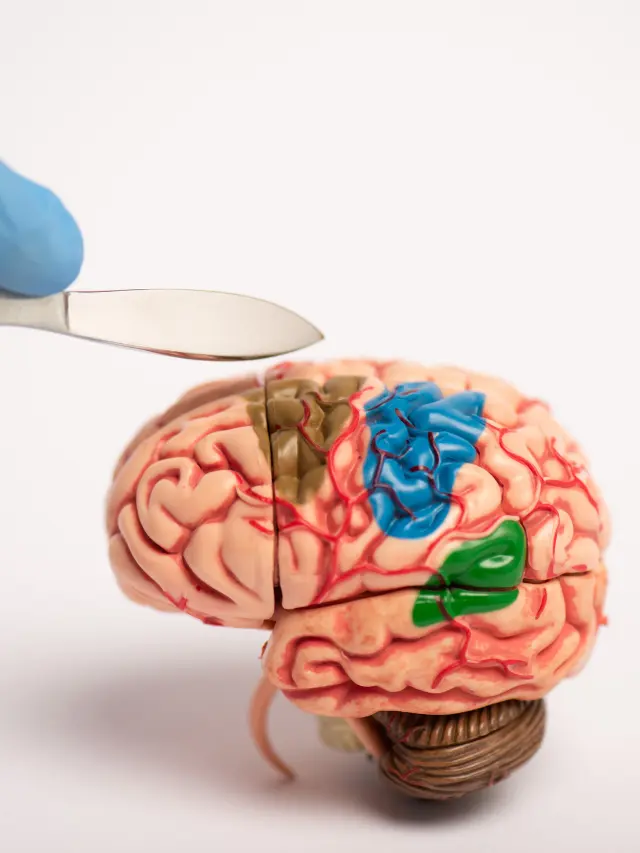 Neurosurgery