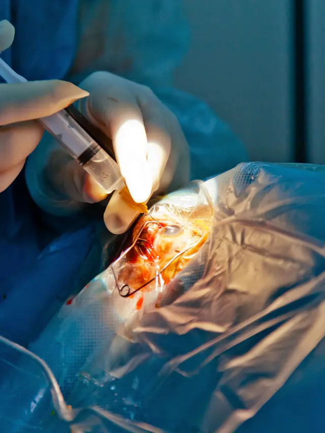 Ortho Surgery