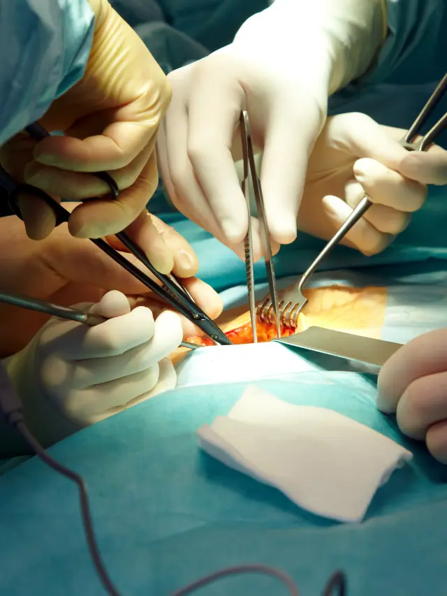 General Surgery