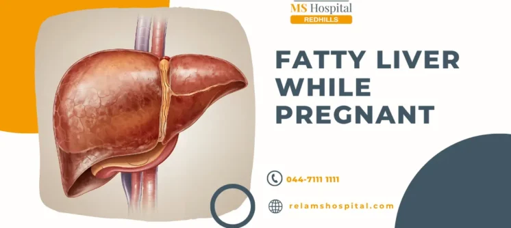 Fatty-Liver-While-Pregnant